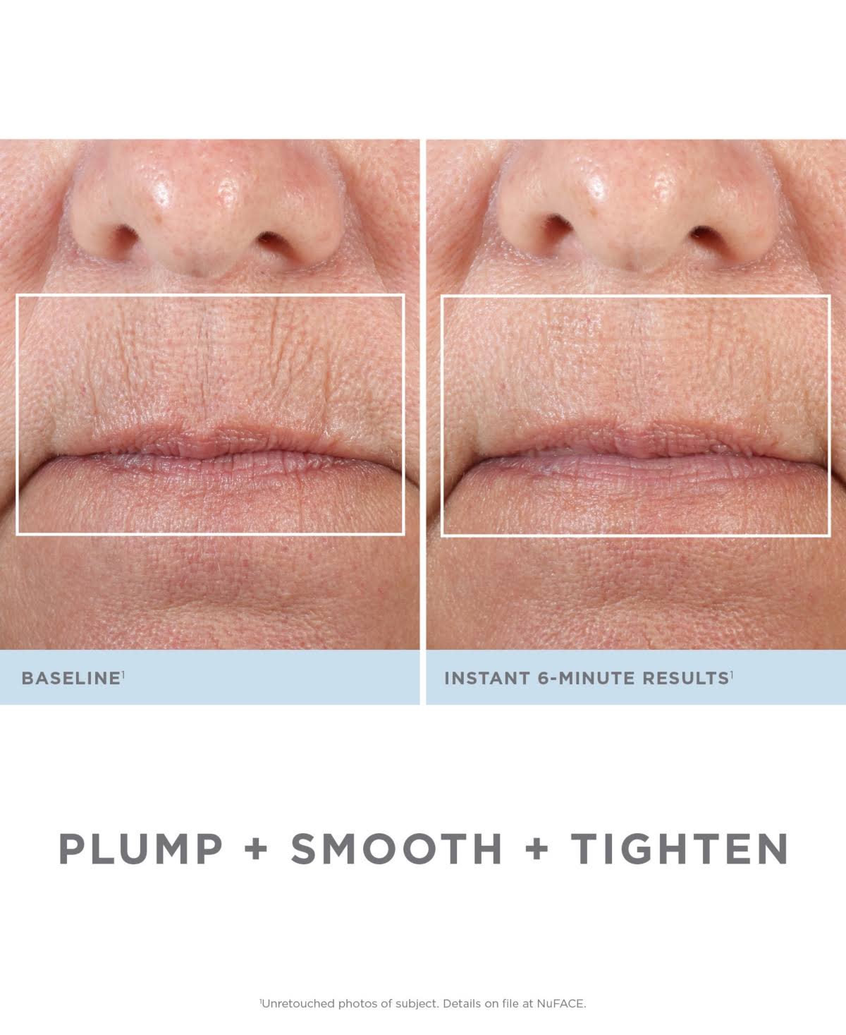 Facial Kit L3861