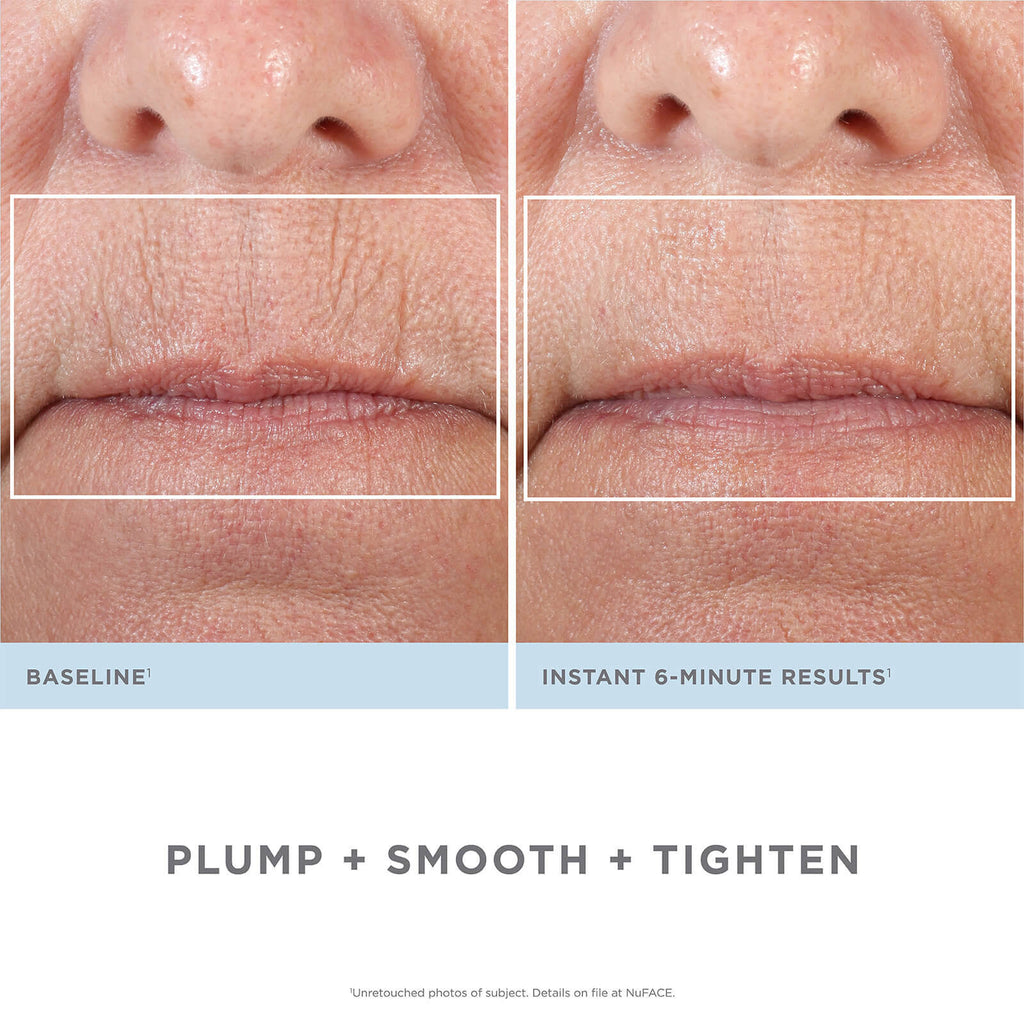 Facial Kit L3861