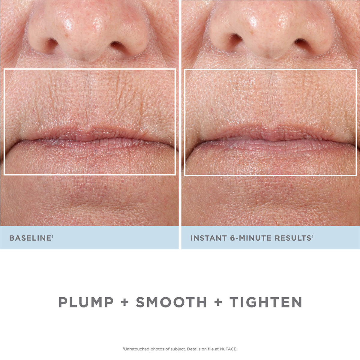 Facial Kit L3861